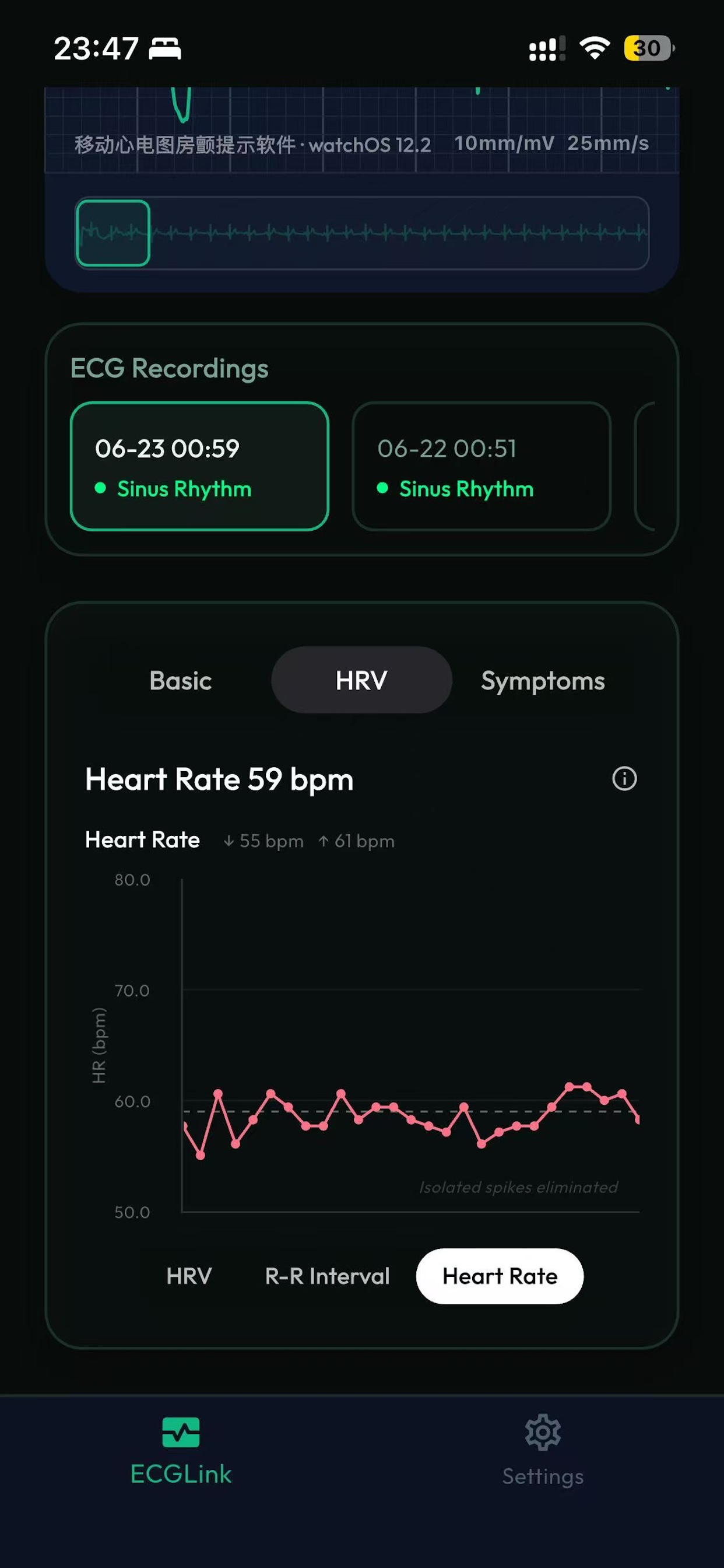 ECGLink heart rate trend screen.