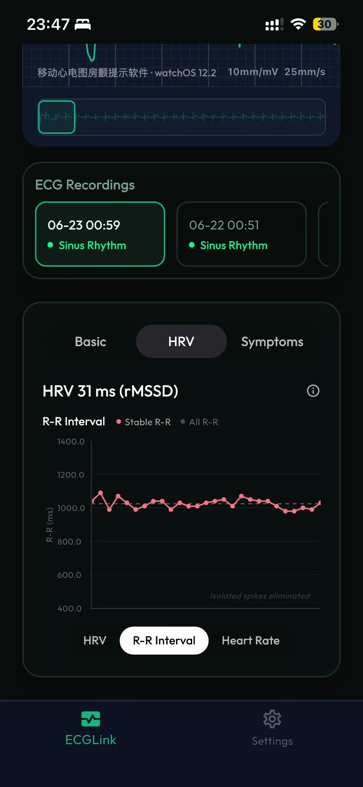 ECGLink R-R interval trend screen.